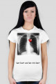 Lungs RTG