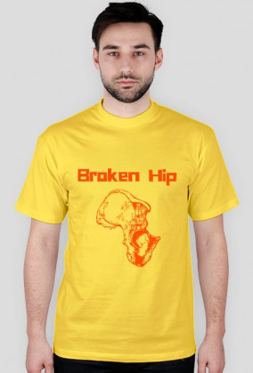 Broken Hip