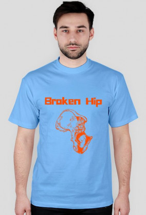 Broken Hip