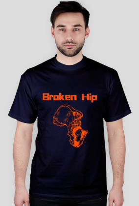 Broken Hip